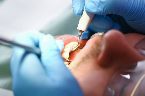 Best Urgent Tooth Repair  in Sleepy Hollow, WY