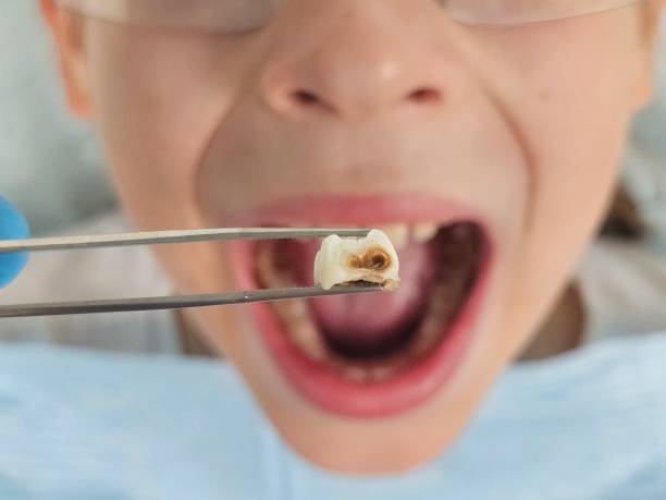 Best Emergency Tooth Extraction  in Sleepy Hollow, WY